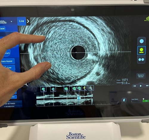 Equip_AVVIGO_Cardiologia