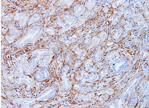 Galectina-1