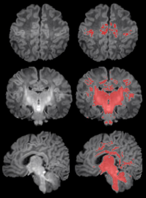 Ressonancia_magnetica_nadons