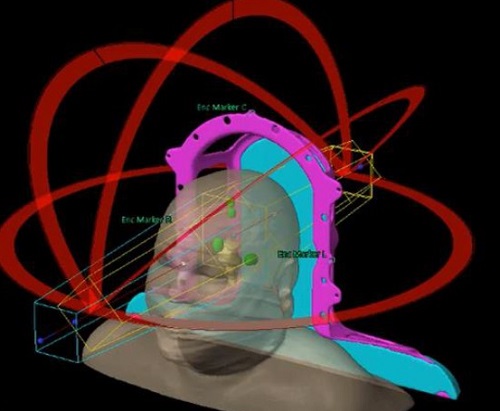 Programari_radioterapia