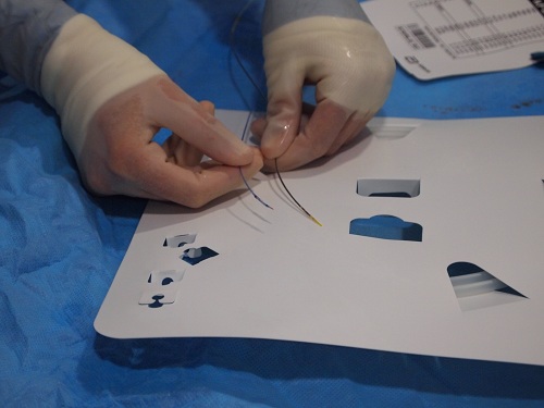 Litoplastia_coronaria