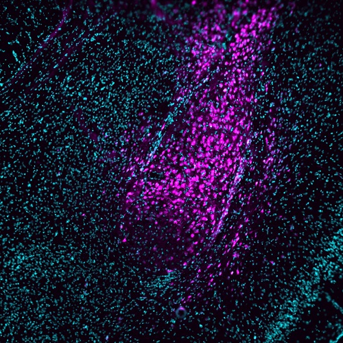 Marcador_Cervell_ratolins