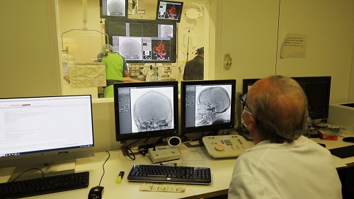 Stent_neuroangiografia