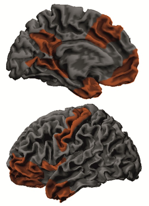 Zones_cervell