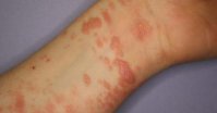 Dermatologia