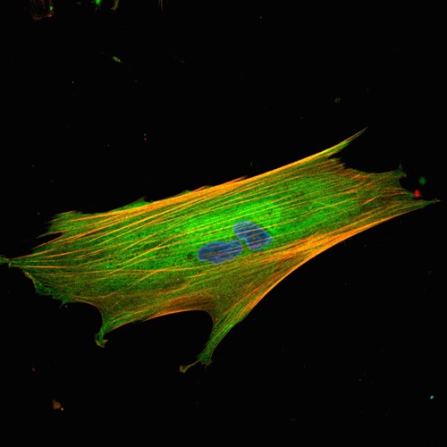 Fibroblast_esudi_Gut