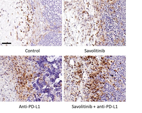 Imatge_estudi_Cell_Reports_Medicine