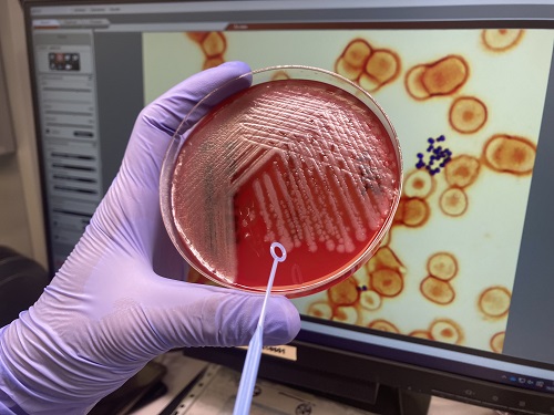 Pseudomonas aeruginosa