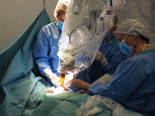 Radioteràpia_intraoperàtoria